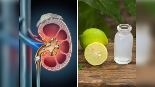 World Kidney Day: घोट घोट प्या हे 6 प्रकारचं पाणी, किडन...                                         