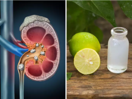 World Kidney Day: घोट घोट प्या हे 6 प्रकारचं पाणी, किडनीतील विषारी घाण लघवीतून पडेल बाहेर, मुतखड्याचा होईल चुरा 