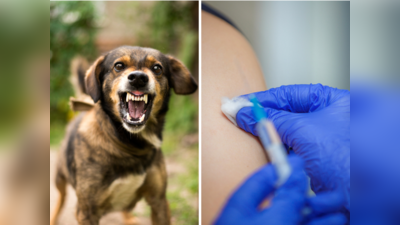 कुत्ते ने काटा, 5 टीके भी लगे, फिर भी रेबीज से महिला की मौत, कुत्ते के काटने पर करें 5 काम, जानें vaccine schedule