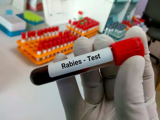 रेबीज की मृत्यु दर (Rabies fatality rate)