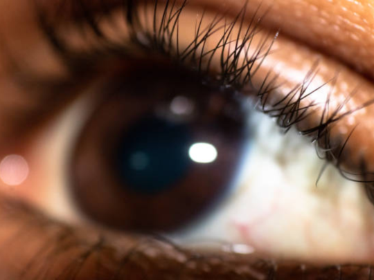 Eye Twitching Causes:शुभ अशुभ नाही तर पापण्यांचे फडफडणं देतं या महाभयंकर आजारांचे संकेत 