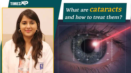 understanding cataracts types causes and treatment options watch video