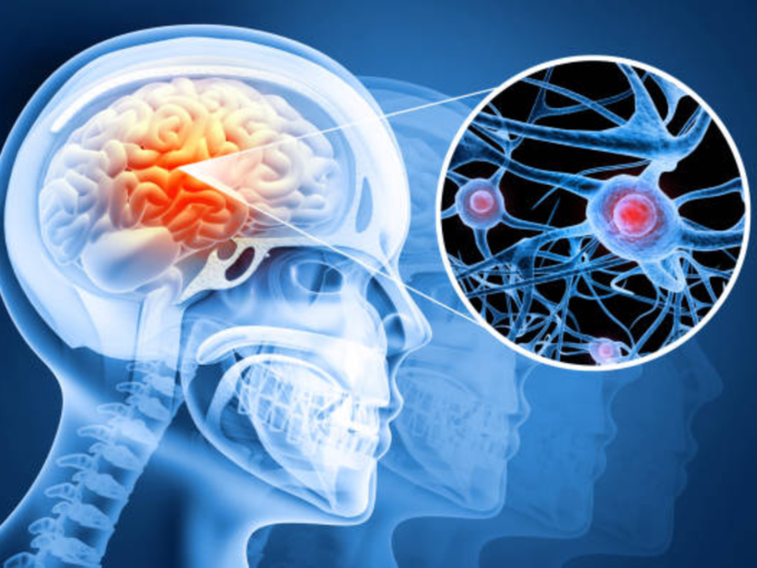 मेंदूत रक्तस्त्राव होण्याची लक्षणे कोणती?