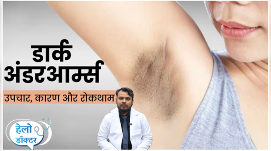 how to get rid of dark underarms causes treatment watch video