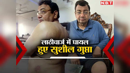 लाठीचार्ज में घायल सुशील गुप्ता ने कपड़े उतार दिखाए जख्म, बोले- BJP की क्रूरता के यह निशान हरियाणा नहीं भूलेगा