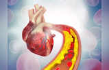 Anti Cholesterol Foods: कोलेस्ट्रॉल को दिल के पास पहुंचने से रोकते हैं 5 फूड, नसों से बाहर चूस लेंगे बीमारी को