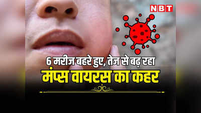 Mumps Virus: राजस्थान में नए वायरस ने मचाया कहर, संक्रमण के बाद 6 मरीज हुए बहरे, पढ़ें क्या कह रहे जयपुर के डॉक्टर