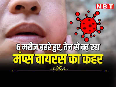 Mumps Virus: राजस्थान में नए वायरस ने मचाया कहर, संक्रमण के बाद 6 मरीज हुए बहरे, पढ़ें क्या कह रहे जयपुर के डॉक्टर