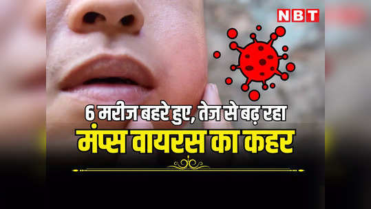 Mumps Virus: राजस्थान में नए वायरस ने मचाया कहर, संक्रमण के बाद 6 मरीज हुए बहरे, पढ़ें क्या कह रहे जयपुर के डॉक्टर