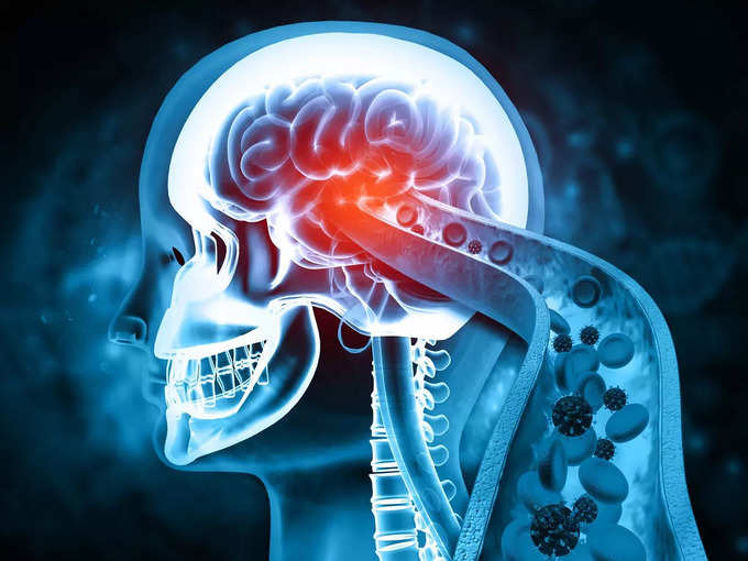 ​ஆக்ஸிஜனேற்ற அழுத்தம் உண்டு செய்யும் Neurodegenerative நியூரோடிஜெனரேட்டிவ் நோய்கள்​