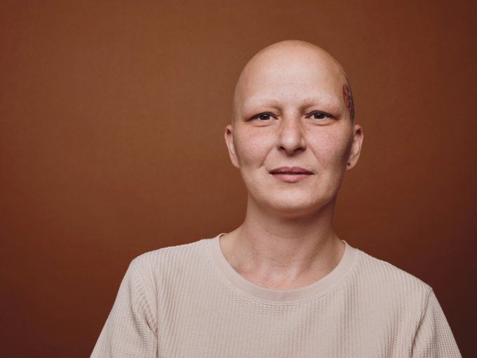 cancer treatment chemotherapy hair loss