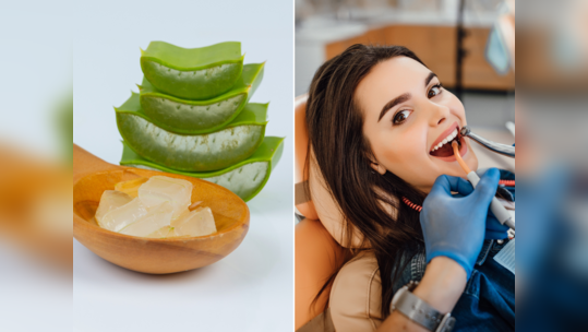 Aloe Vera For Teeth: પેઢામાં છાલા-કમજોર દાંત ઉપરાંત સડાની સમસ્યાને ઝડપથી દૂર કરશે એલોવેરા, મજબૂત થશે બત્તીસી 