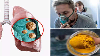 How To Make Lungs Strong: गंदगी से सिकुड़ रहे फेफड़ों में जान भरेंगे रामदेव के 4 नुस्खे, खुलकर मिलेगी ऑक्सीजन