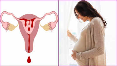 Pregnancy on Period: পিরিয়ড চলাকালীন কি প্রেগনেন্ট হতে পারেন আপনি? সত্যিটা জেনে নিন