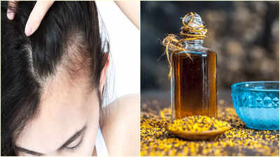 Homemade Hair Oil: হেয়ার ফলের জেরে মাথার সামনে পড়েছে টাক? মেথির এই DIY তেলের গুণে এক ঢাল চুল পাবেন এবার!