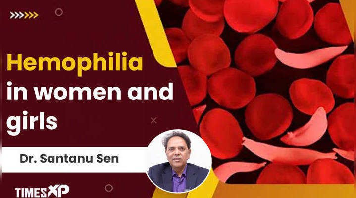 hemophilia it affects women and girls too watch video