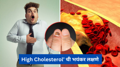 High Cholesterol ने शरीराची प्रत्येक नस ब्लॉक झालीए? बोटांमध्ये ही लक्षणे दिसल्यास हॉस्पिटलमध्ये धाव घ्या 
