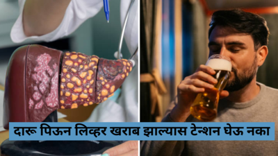 Liver failure: दारू पिऊन लिव्हर डॅमेज झाल्यास टेन्शन घेऊ नका, डॉ सरीनने सांगितले घरगुती उपाय