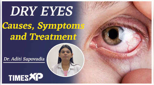 dry eyes causes symptoms and treatments
