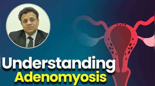 understanding adenomyosis symptoms causes and treatment options