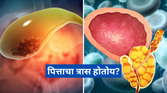 Acidity; पित्ताचा त्रास होतोय? करा हे घरगुती उपाय लगेच मिळेल आराम