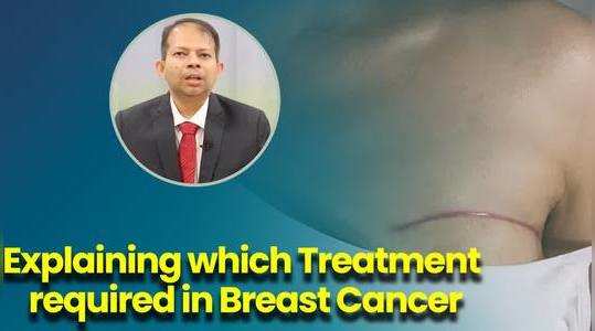 expert explains breast cancer treatment