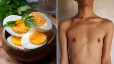 Egg In Summer: अंडे खाने से बढ़ती है गर्मी! अगर कर दी ये गलती तो शरीर को नहीं मिलेगी ताकत