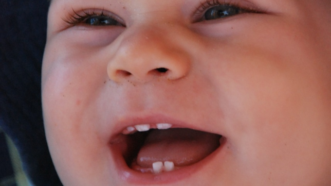 Baby Teeth