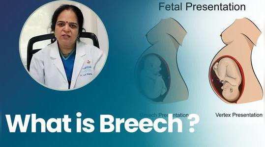 what is breech dr jyoti sharma explain timesxp