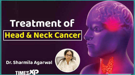 dr sharmila agrawal told how we can deal with head and neck cancer