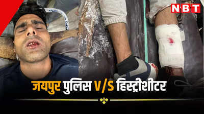 जयपुर पुलिस और हिस्ट्रीशीटर के बीच फायरिंग, दिल्ली से जयपुर लाते समय 1.25 लाख के इनामी राकेश के पैर में लगी गोली