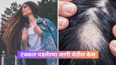 गुडघ्यापर्यंत झुपकेदार केसांसाठी घरगुती तेल, टक्कल पडलेल्या जागी येतील केस