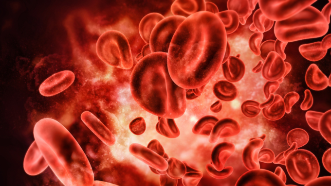 How many types of aplastic anemia are there?