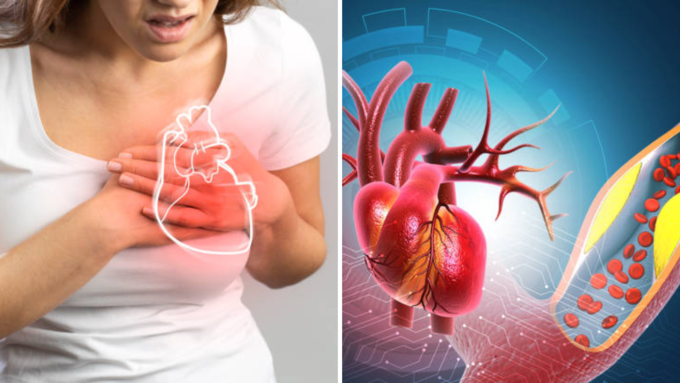 हृदयावर होणारे कोलेस्टेरॉलचे प्रकार आणि परिणाम