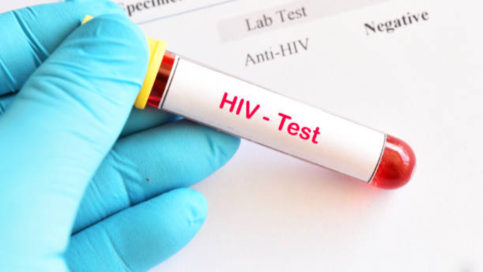 एचआयव्हीची तपासणी आणि निदान