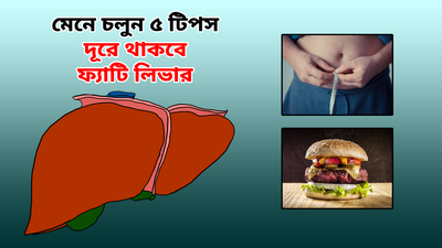 যকৃতের বারোটা বাজায় Fatty Liver Disease, ৫ টিপস মেনে রোগ প্রতিরোধ করুন