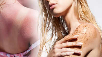 Summer Skin Care Tips: রোদে পুড়ে রং বদলেছে ত্বকের? স্নানের আগে এই ছোট্ট কাজেই মুক্তি মিলবে সানট্যান থেকে