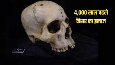 मिस्र में 4000 साल पहले भी होती था कैंसर का इलाज, इंसानी खोपड़ी में मिले सबूत