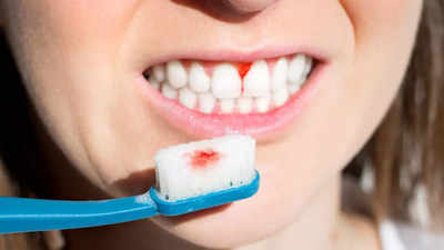 सेंसिटिविटी से परेशान हैं? दांतों को तेजी से खराब करती हैं ये 5 चीजें, दूरी बना लेंगे तो उम्र हो जाएगी लंबी