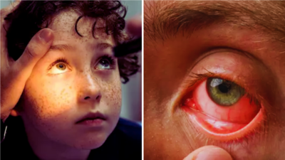 Eye Cancer in Children: ऐसे बच्चों को है आंख के कैंसर का सबसे ज्यादा खतरा, Dr. ने बताया रोकथाम और इलाज