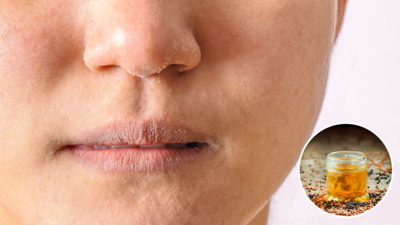Home Remedies For Dry Nose: हमेशा नाक रहती है सूखी हुई तो ट्राई करें ये 5 देसी इलाज