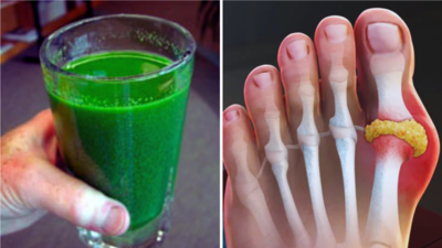 Uric Acid की दमदार दवा है ये हरा पानी, Ayurveda डॉ. ने माना-दवाओं के बिना खून से बह जाएगी गंदगी