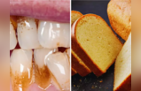 या 5 गोष्टी खाऊन तुमचे दात झाले पिवळेधम्मक? किचनमधली ही वस्तू दातांवर रगडायला करा चालू, सेकंदात लख्ख होईल बत्तीशी