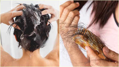 Hair Fall For Shampoo: শ্যাম্পু করলে কি চুল পড়া বাড়ে? উত্তর দিলেন বিশিষ্ট চিকিৎসক