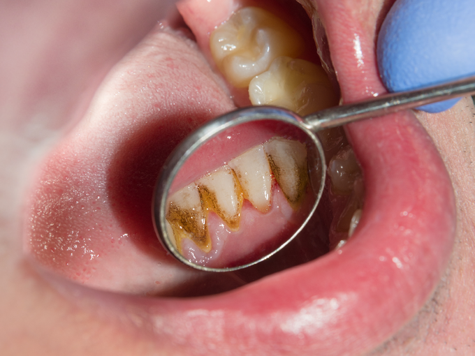 slide 4 oral health