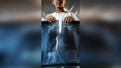 ई-सिगारेटचा श्वसनाच्या आरोग्यावर होतो घातक परिणाम