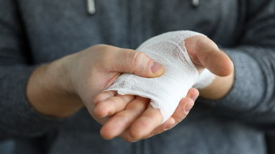 How To Stop Bleeding: चोट से नहीं रुक रहा खून, तो करके देखें ये उपाय, ब्लीडिंग हो जाएगी बंद