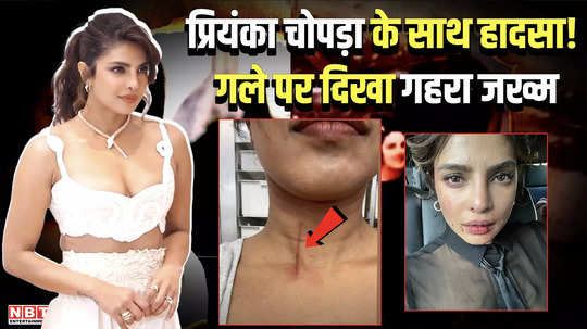 priyanka chopra got injured on the sets of film the bluff watch video