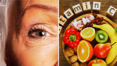 Vitamin C Side Effects: तगड़ा है पर खतरा है! सेहत को 5 गंभीर मुसीबत दे सकता है विटामिन सी का ज्यादा सेवन