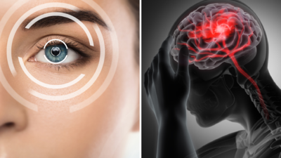 अगर आंख में होती हैं ये दिक्कतें तो हो सकता है दिमाग में बढ़ रहा है ट्यूमर, पहचानकर करवाएं जांच